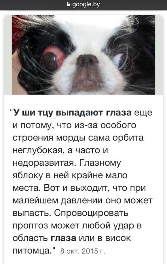 Структура глаза